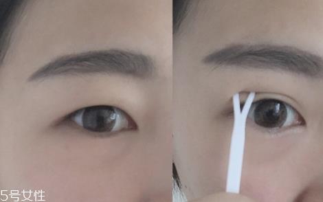 双眼皮贴一般多少钱？