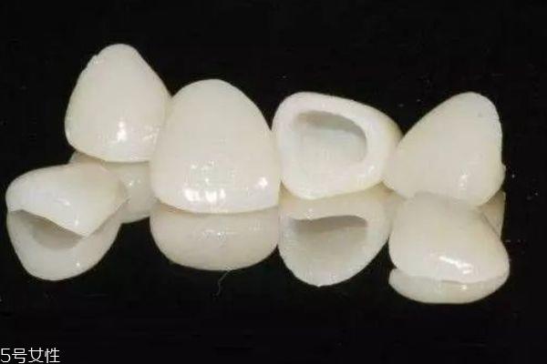 牙齿泛黄应该怎么办呢 为什么牙齿会泛黄 牙齿泛黄应该怎么办呢 为什么牙齿会泛黄