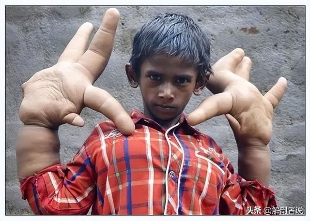 各手指解剖图及名称（白话解剖奇怪的手指）(2)