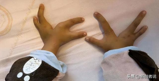 各手指解剖图及名称（白话解剖奇怪的手指）(7)