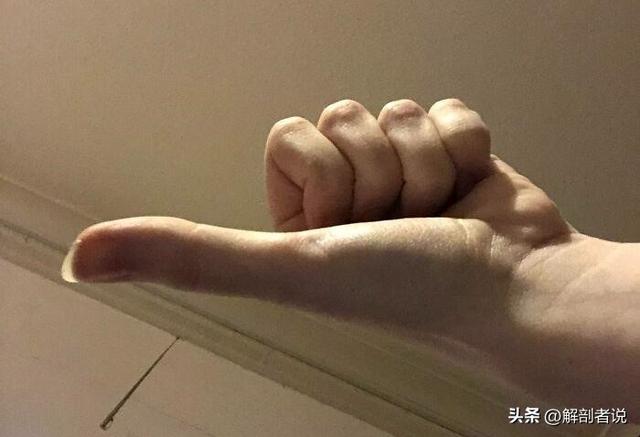 各手指解剖图及名称（白话解剖奇怪的手指）(4)