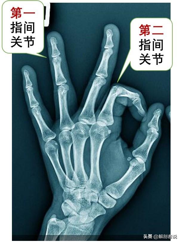 各手指解剖图及名称（白话解剖奇怪的手指）(11)