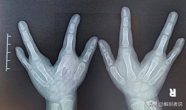 各手指解剖图及名称（白话解剖奇怪的手指）(8)