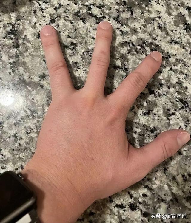 各手指解剖图及名称（白话解剖奇怪的手指）(5)