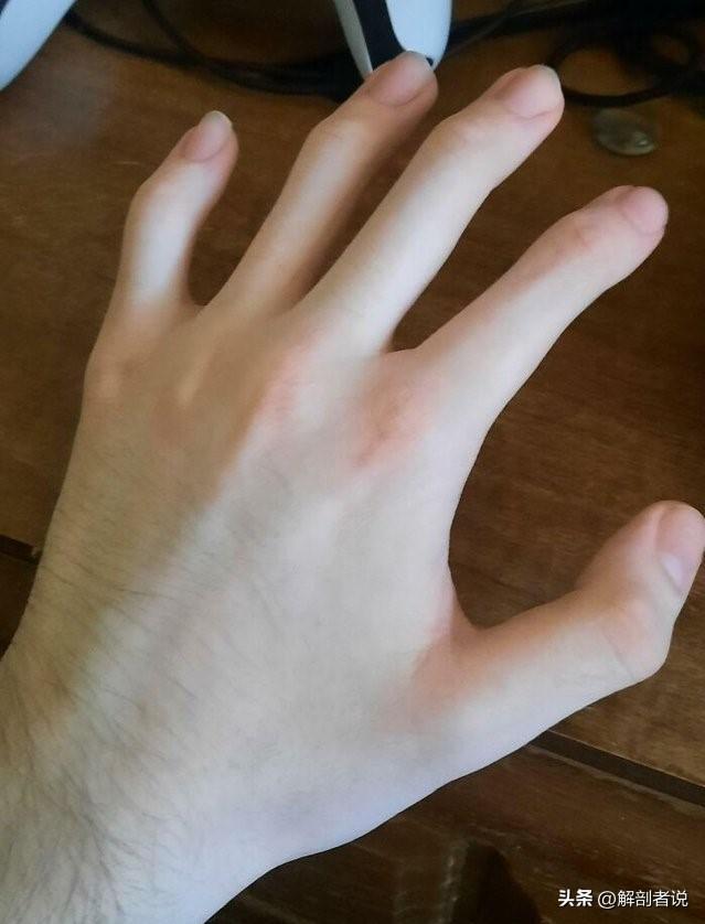 各手指解剖图及名称（白话解剖奇怪的手指）(12)